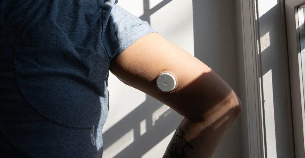 Continuous Glucose Monitoring: The Year-Long Journey